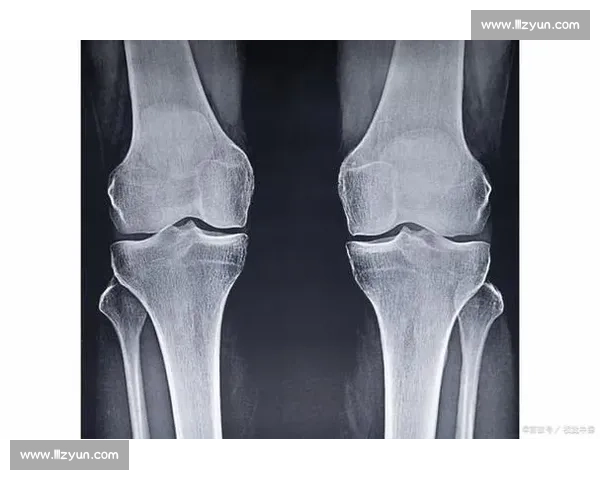 18 岁骨骺线未闭合？科学 3 招助你再长高 5cm